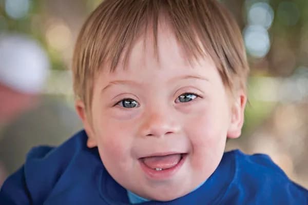 A smiling toddler with Down syndrome