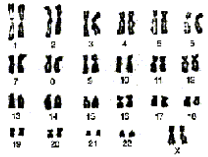 A typical karyotype: 23 pairs of chromosomes